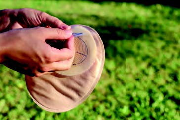 CUIDADO INTEGRAL DEL PACIENTE PORTADOR DE UNA OSTOMÍA DE ELIMINACIÓN