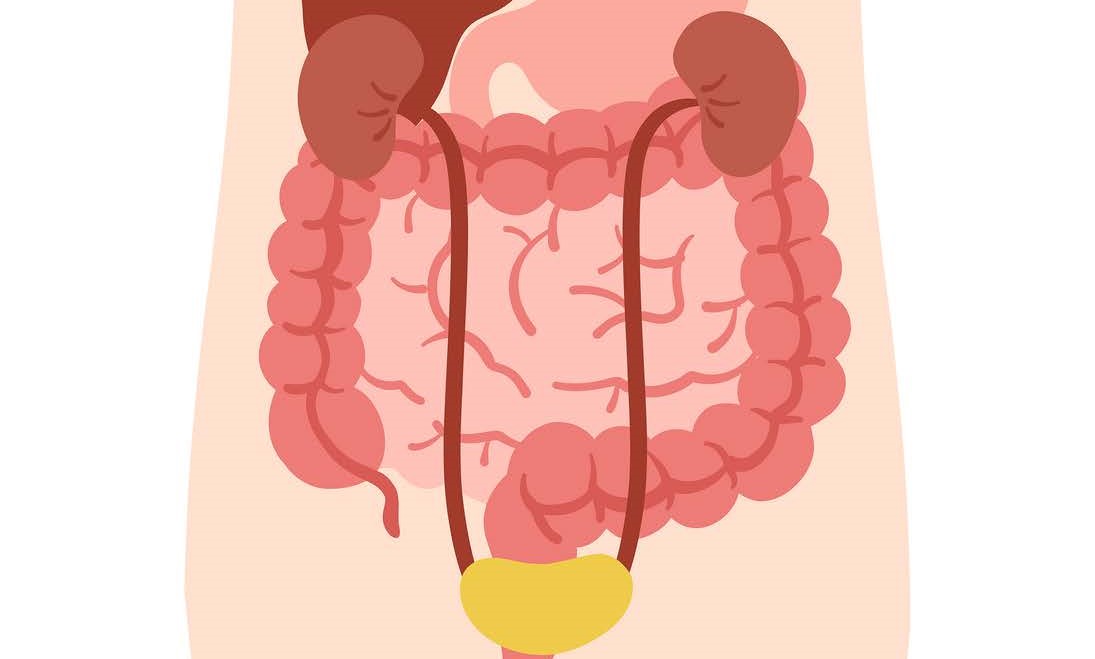 DIÁLISIS PERITONEAL PARA ENFERMERÍA